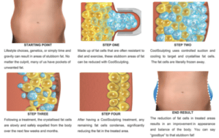 Call me guess fat cells