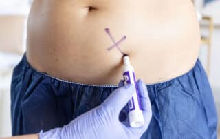 coolsculpting at bodify stop wasting money on ineffective fat loss solutions