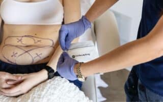 Image about why coolsculpting is a popular choice for body contouring by bodify Call Today 602.354.8040