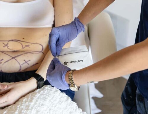 Why CoolSculpting is a Popular Choice for Body Contouring