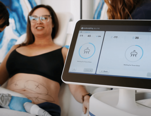 Can CoolSculpting Elite Help with Body Contouring for Weight Loss Maintenance?