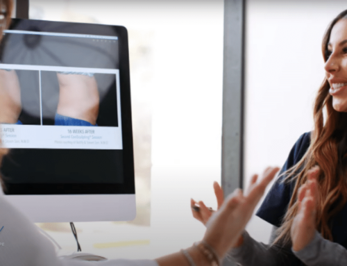 What Are the Long-Term Benefits of CoolSculpting for Body Contouring?